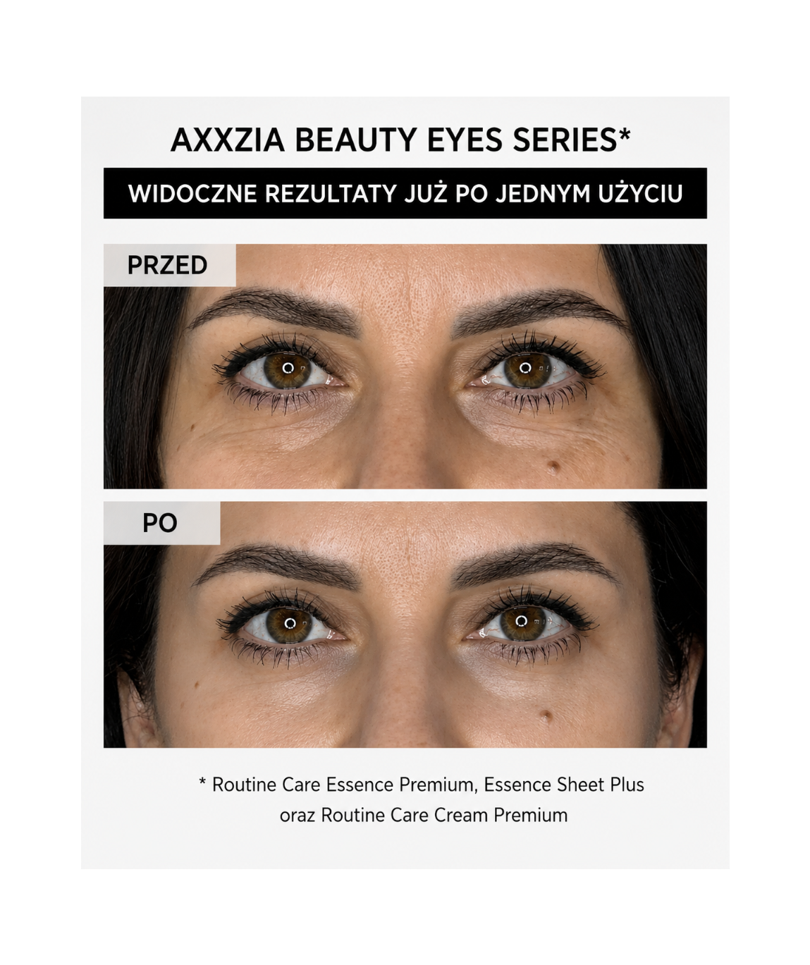 AXXZIA Beauty Eyes Essence Sheet Plus – efekty przed i po jednym użyciu, redukcja cieni i zmarszczek pod oczami
