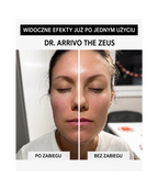 Dr. Arrivo Zeus II PLus (Black) - Urządzenie kosmetyczne premium*