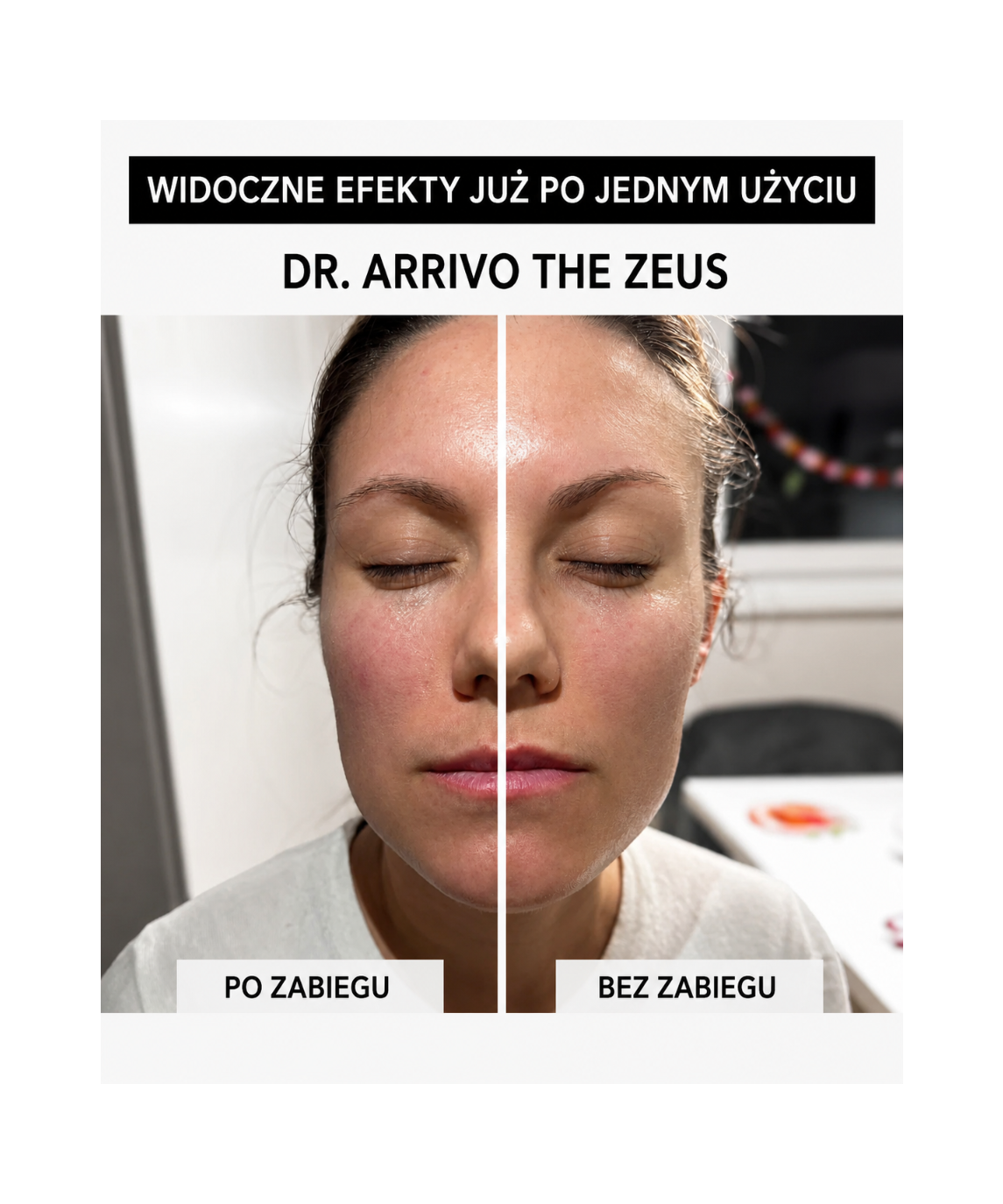 Dr. Arrivo Zeus II PLus (Black) - Urządzenie kosmetyczne premium*