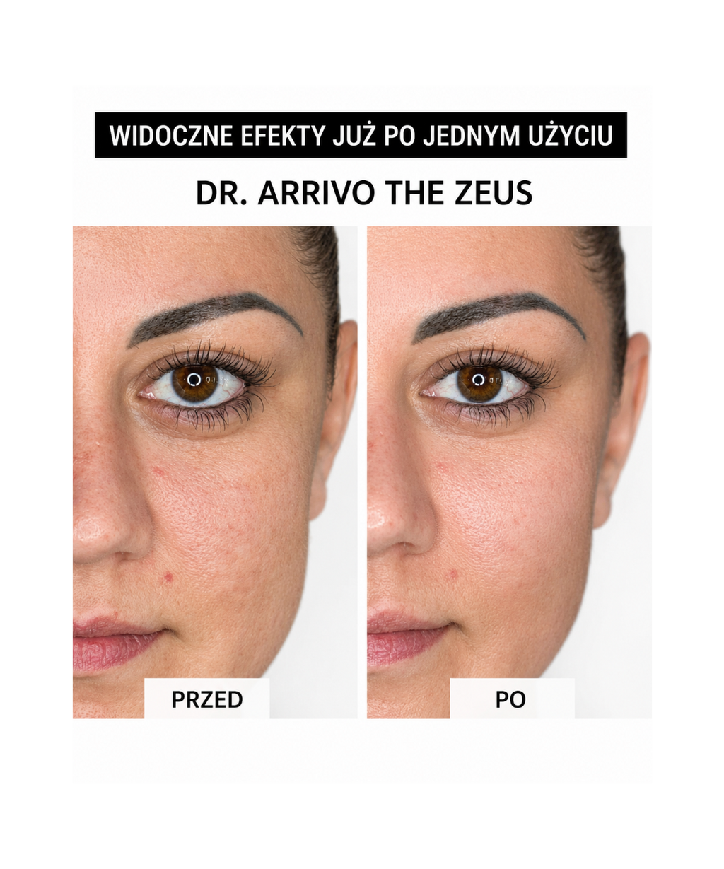 Dr. Arrivo Zeus II PLus (Black) - Urządzenie kosmetyczne premium*