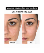 Dr. Arrivo Zeus II PLus (Black) - Urządzenie kosmetyczne premium*