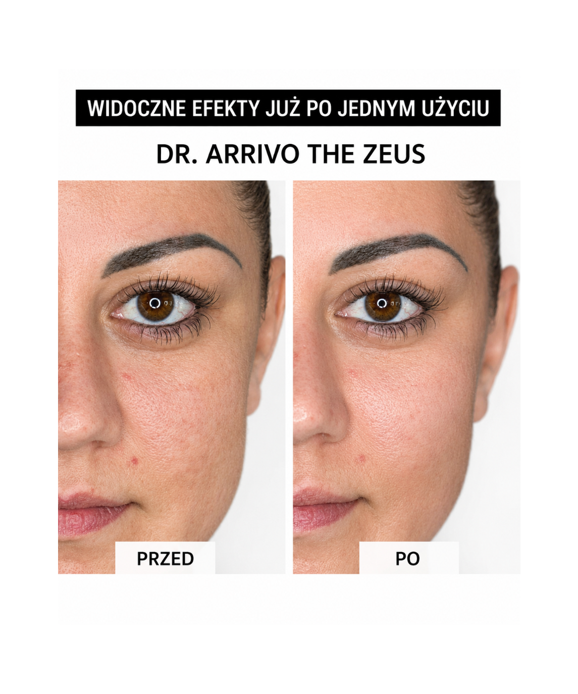 Dr. Arrivo Zeus II PLus (Black) - Urządzenie kosmetyczne premium*