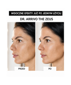 Dr. Arrivo Zeus II PLus (Black) - Urządzenie kosmetyczne premium*