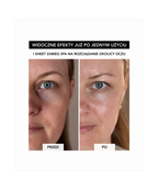 Spa Treatment NMN Sheet Mask – Maska w płachcie z NMN do głębokiej regeneracji i odmłodzenia skóry*
