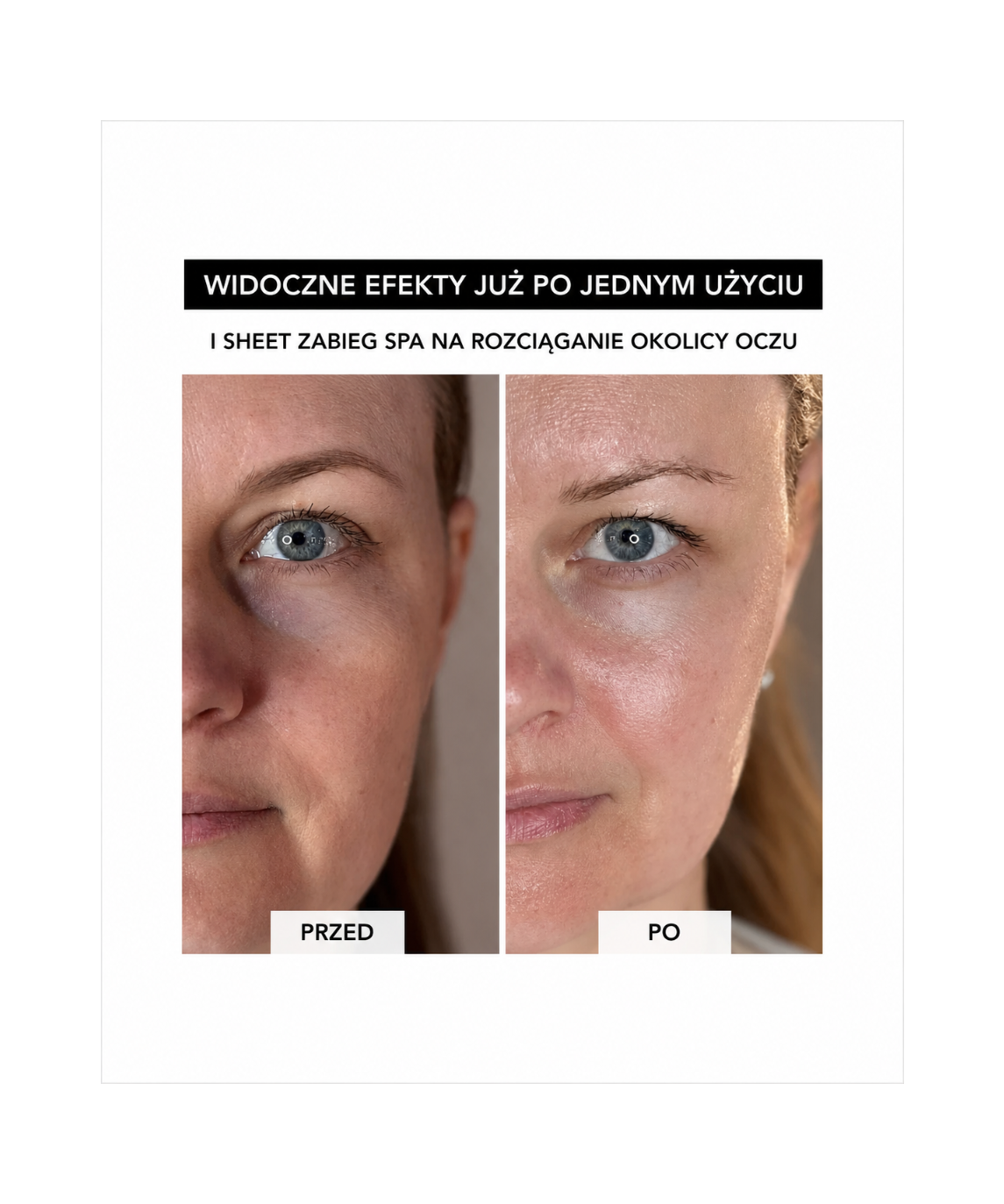 Spa Treatment NMN Sheet Mask – Maska w płachcie z NMN do głębokiej regeneracji i odmłodzenia skóry*