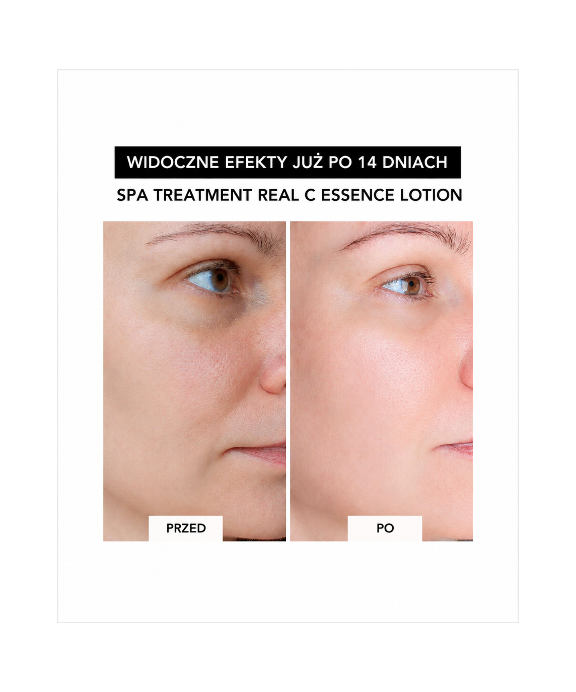 Real C-essence lotion - Nawilżający lotion z 5% witaminą C, niacynamidem i retinolem