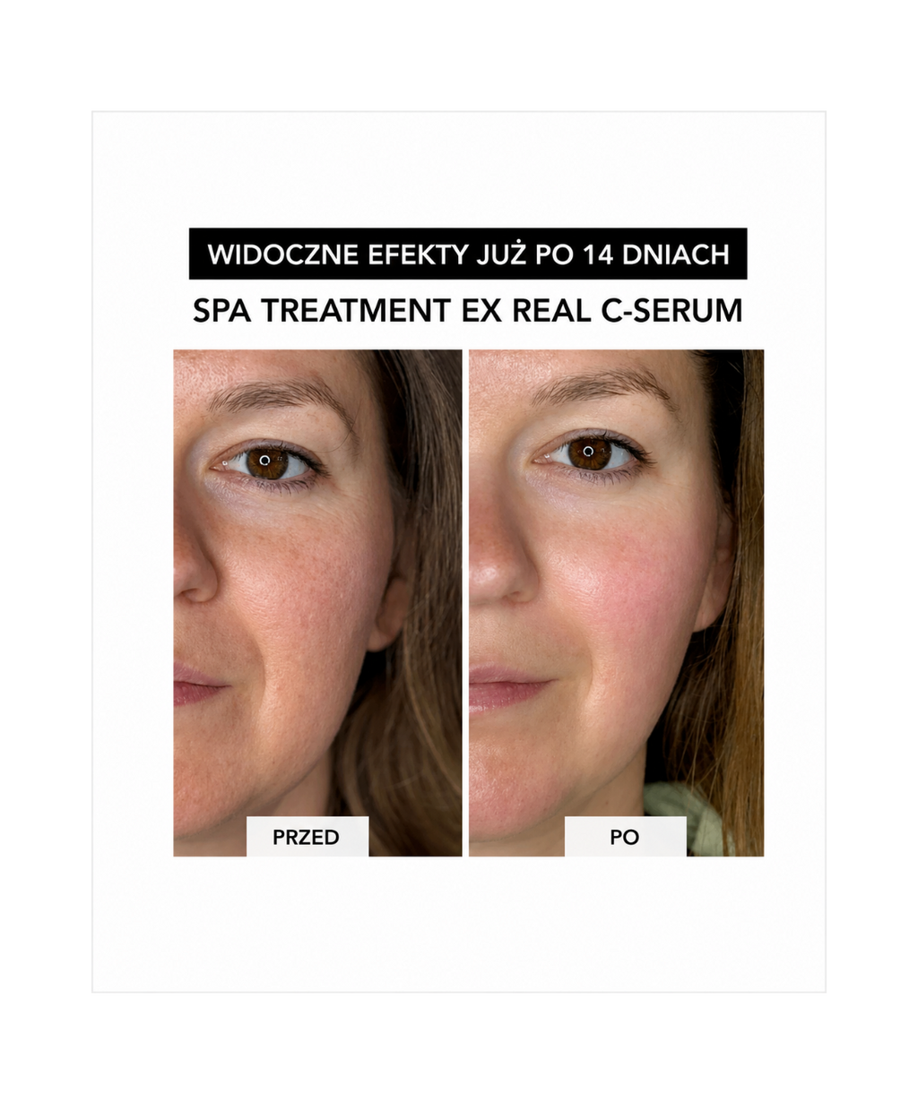 Spa Treatment Real C-Serum –  Z czystą witaminą C dla rozświetlenia i odmłodzenia skóry*