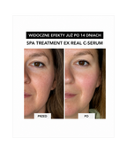 Spa Treatment Real C-Serum –  Z czystą witaminą C dla rozświetlenia i odmłodzenia skóry*