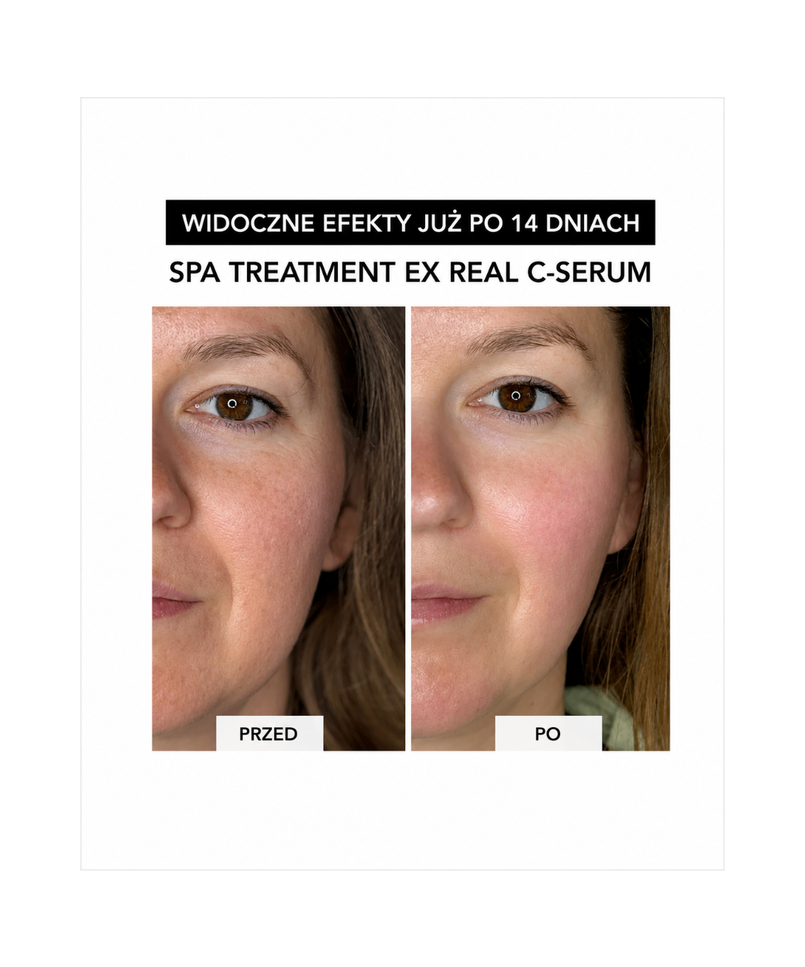 Spa Treatment Real C-Serum –  Z czystą witaminą C dla rozświetlenia i odmłodzenia skóry*