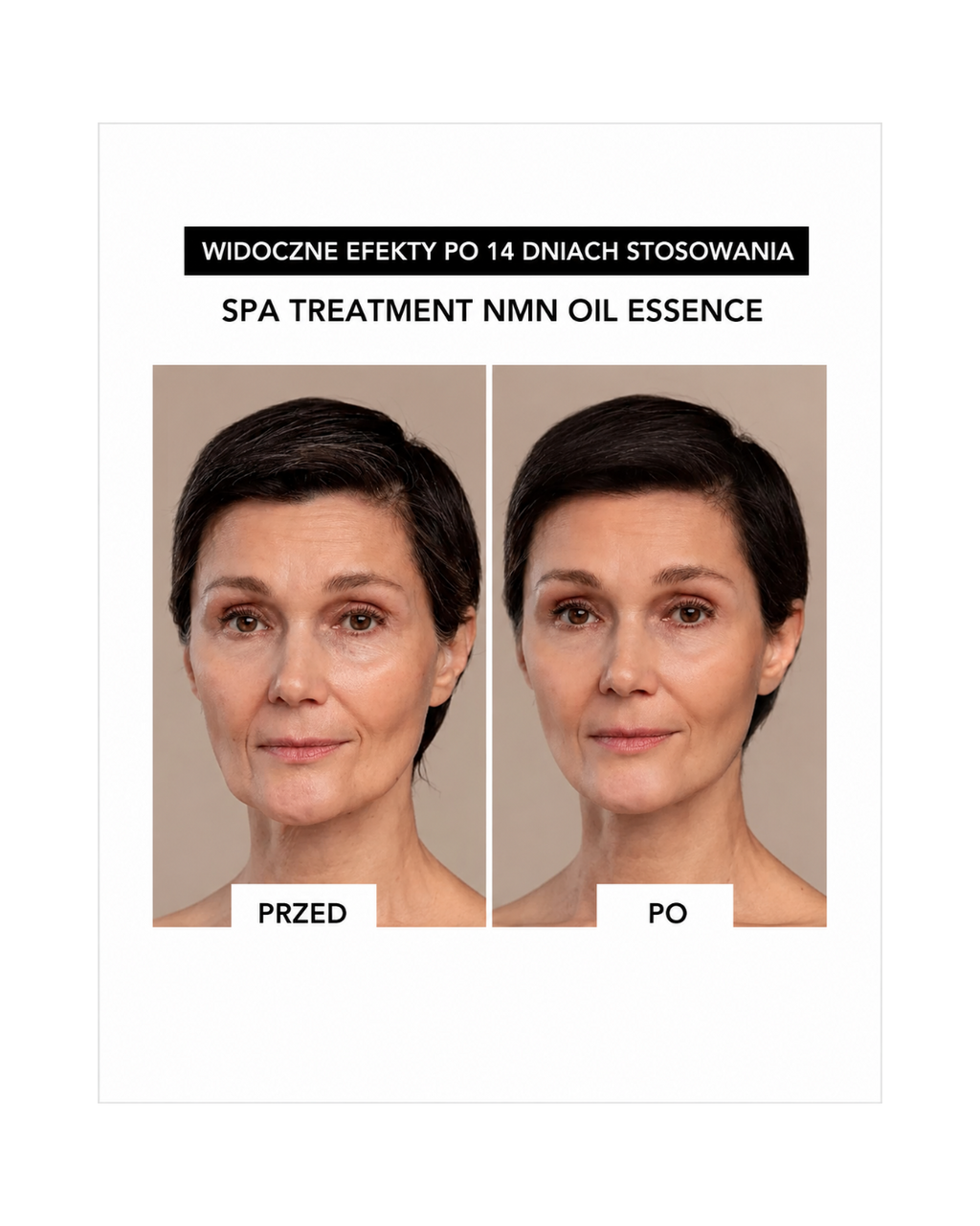 Spa Treatment NMN Oil Essence – Luksusowa esencja olejkowa z NMN do regeneracji komórkowej skóry dojrzałej