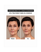 Spa Treatment NMN Oil Essence – Luksusowa esencja olejkowa z NMN do regeneracji komórkowej skóry dojrzałej