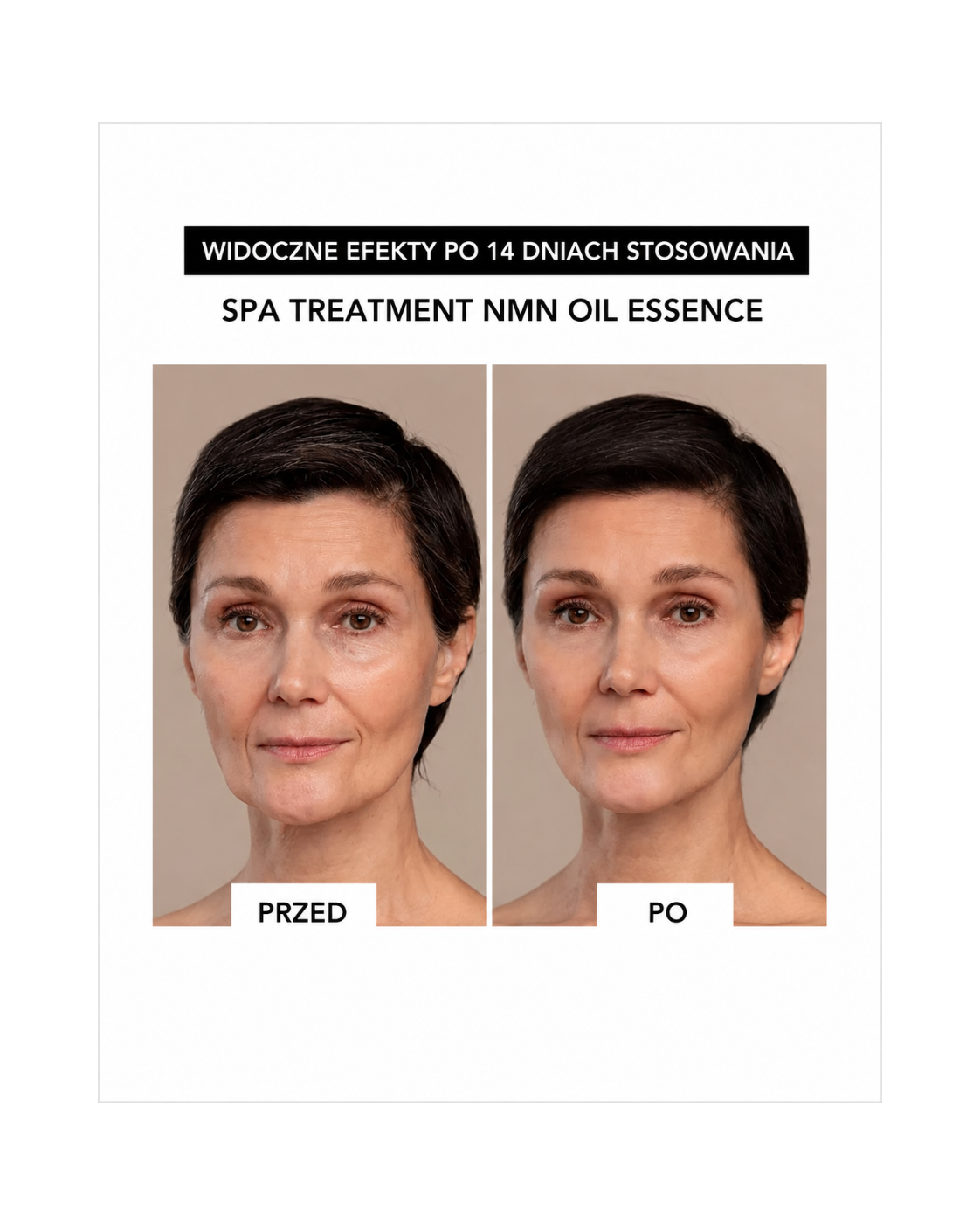Spa Treatment NMN Oil Essence – Luksusowa esencja olejkowa z NMN do regeneracji komórkowej skóry dojrzałej