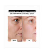 “VITAMIN & COLLAGEN DUO SET” - Skomponowany zestaw do odmładzania i intensywnej regeneracji skóry*