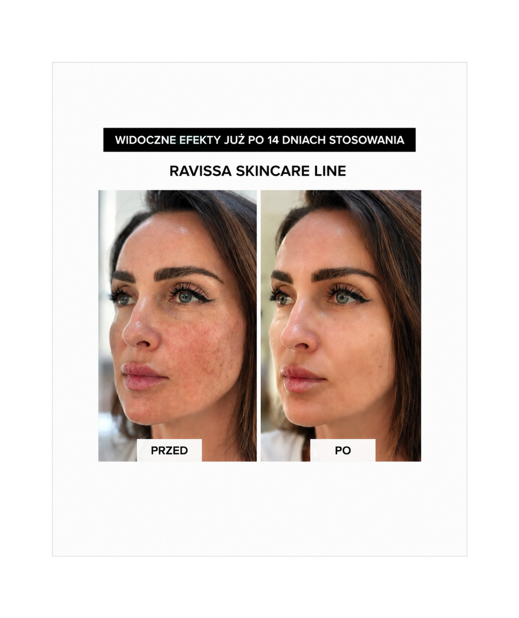 Ravissa Deep Surge Lotion III - Intensywne nawilżenie i regeneracja z kompleksem peptydowym*
