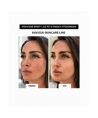 Ravissa Deep Surge Lotion III - Intensywne nawilżenie i regeneracja z kompleksem peptydowym*