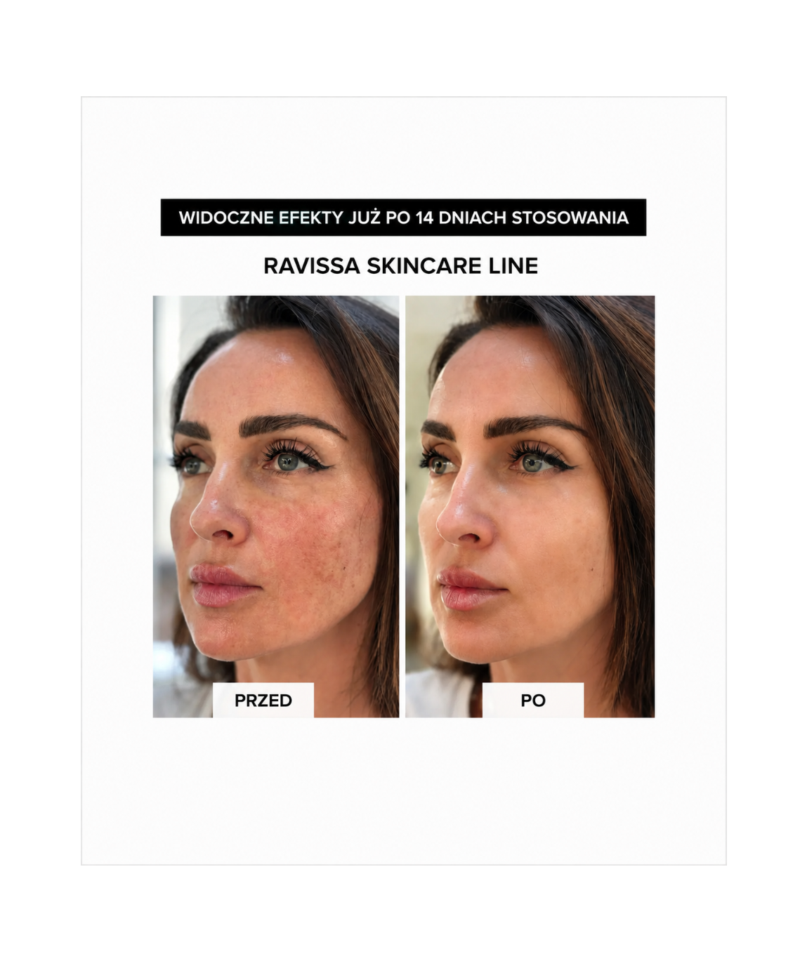 Ravissa Serum Cleansing I - Serum do doskonałego oczyszczania i rozświetlenia skóry*