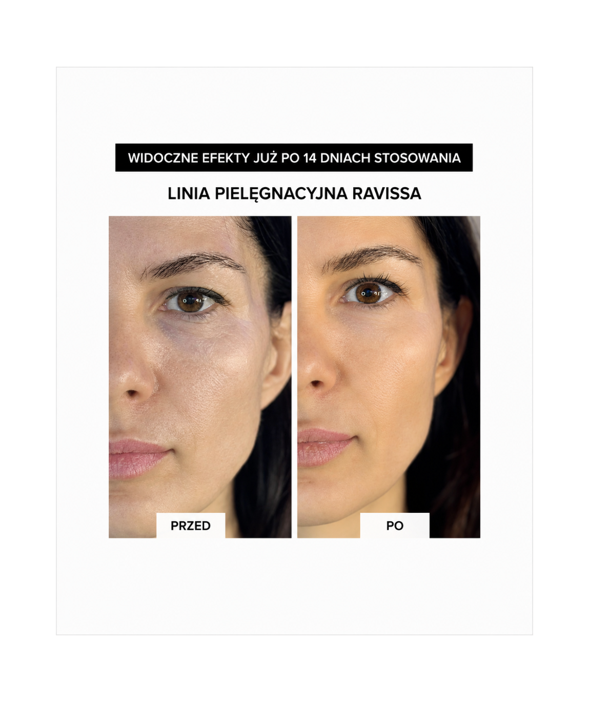 Ravissa Serum Cleansing I - Serum do doskonałego oczyszczania i rozświetlenia skóry*