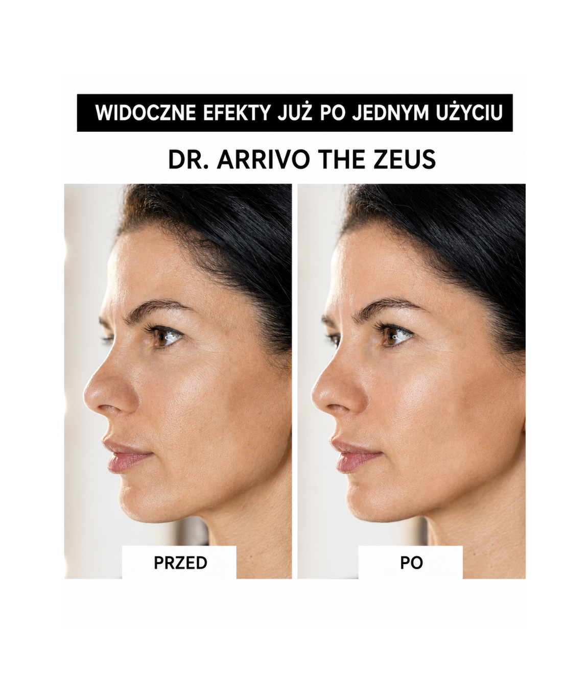 Dr. Arrivo Zeus II Pink - Urządzenie kosmetyczne premium*