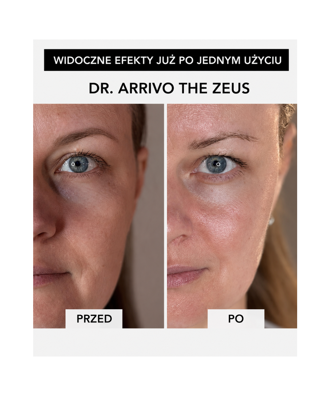 Dr. Arrivo Zeus IV - Luxsusowe urządzenie kosmetyczne nowej generacji*