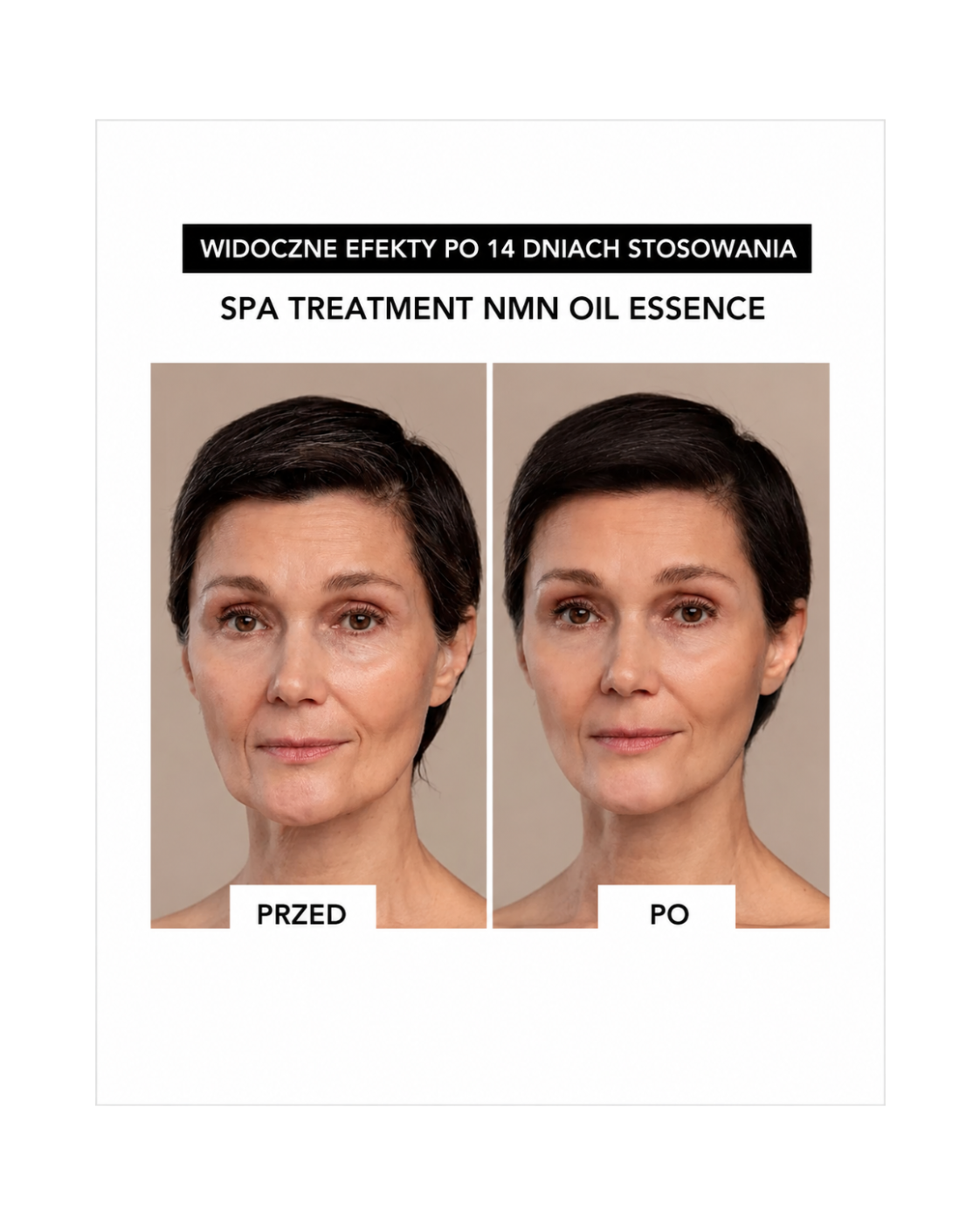 Spa Treatment NMN Duo Set NMN – Rytuał blasku i jędrności skóry*